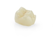 IPS_e.max_ZirCAD_MT_Multi_crown_chairside glaze_stains