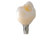 IPS e.max Press Abutment Solutions_PS_001